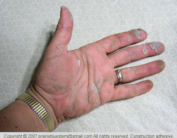 Hands coated with construction adhesive