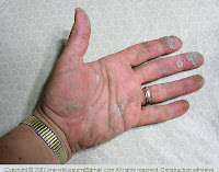 Hands coated with construction adhesive