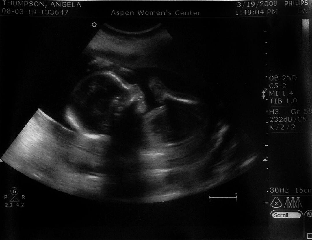 [piper+ultrasound+20+weeks+(small).jpg]