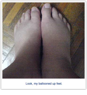 [feet.jpg]