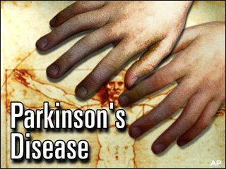 [stock_parkinsons_disease.jpg]