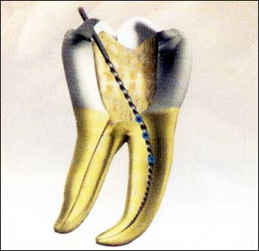 [root+canal.jpg]