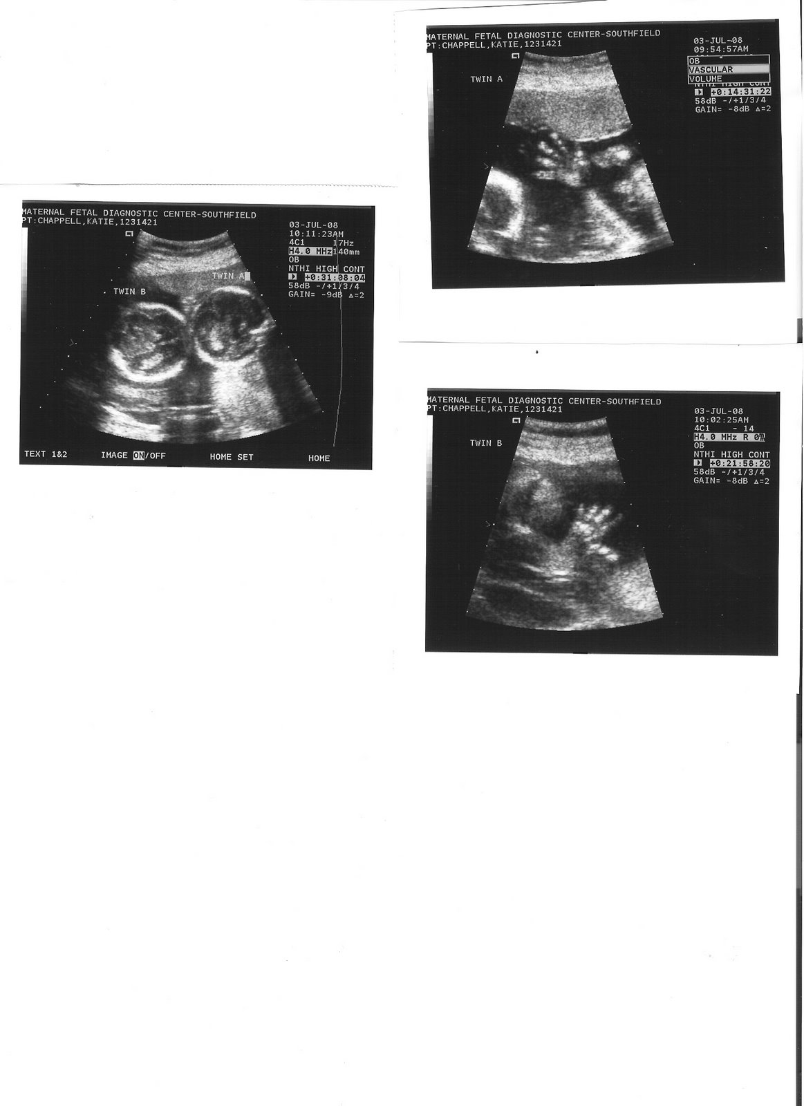 [third+ultrasound+baby+hands.jpg]