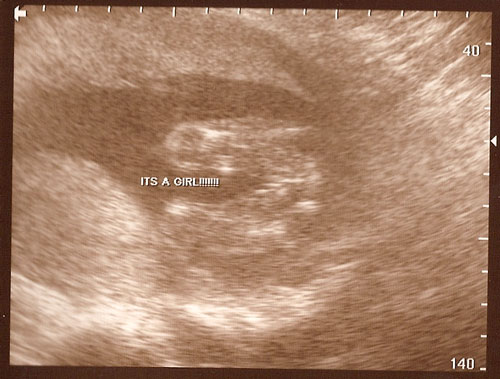 [Ultrasound1.jpg]