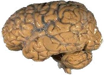 [Human_brain_NIH.jpg]