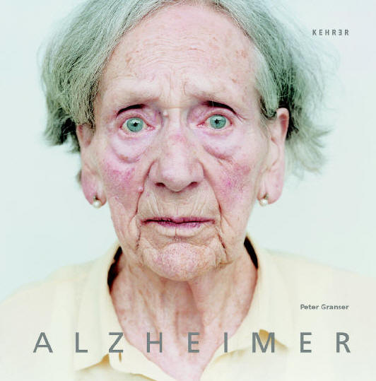[Peter-Granser_Alzheimer-+بمرض+الزهايمر.jpg]