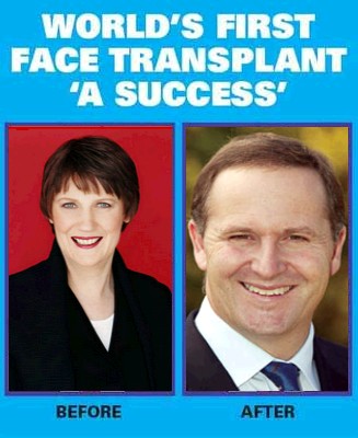 [face-transplant.jpg]