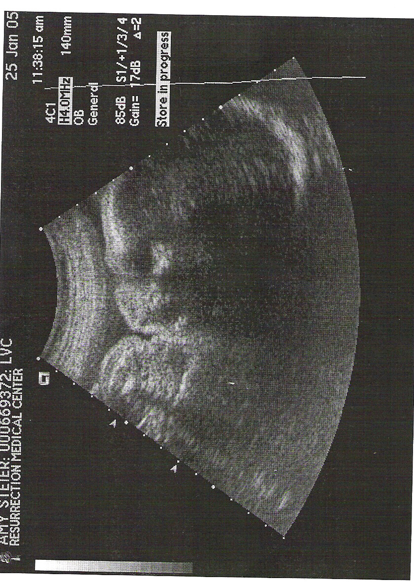[January+25th+Ultrasound.jpg]