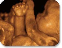[baby_ultrasound.jpg]