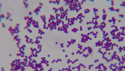 [Staphylococcus+epidermidis.2.jpg]