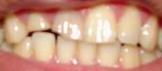 [teeth+problem.JPG]