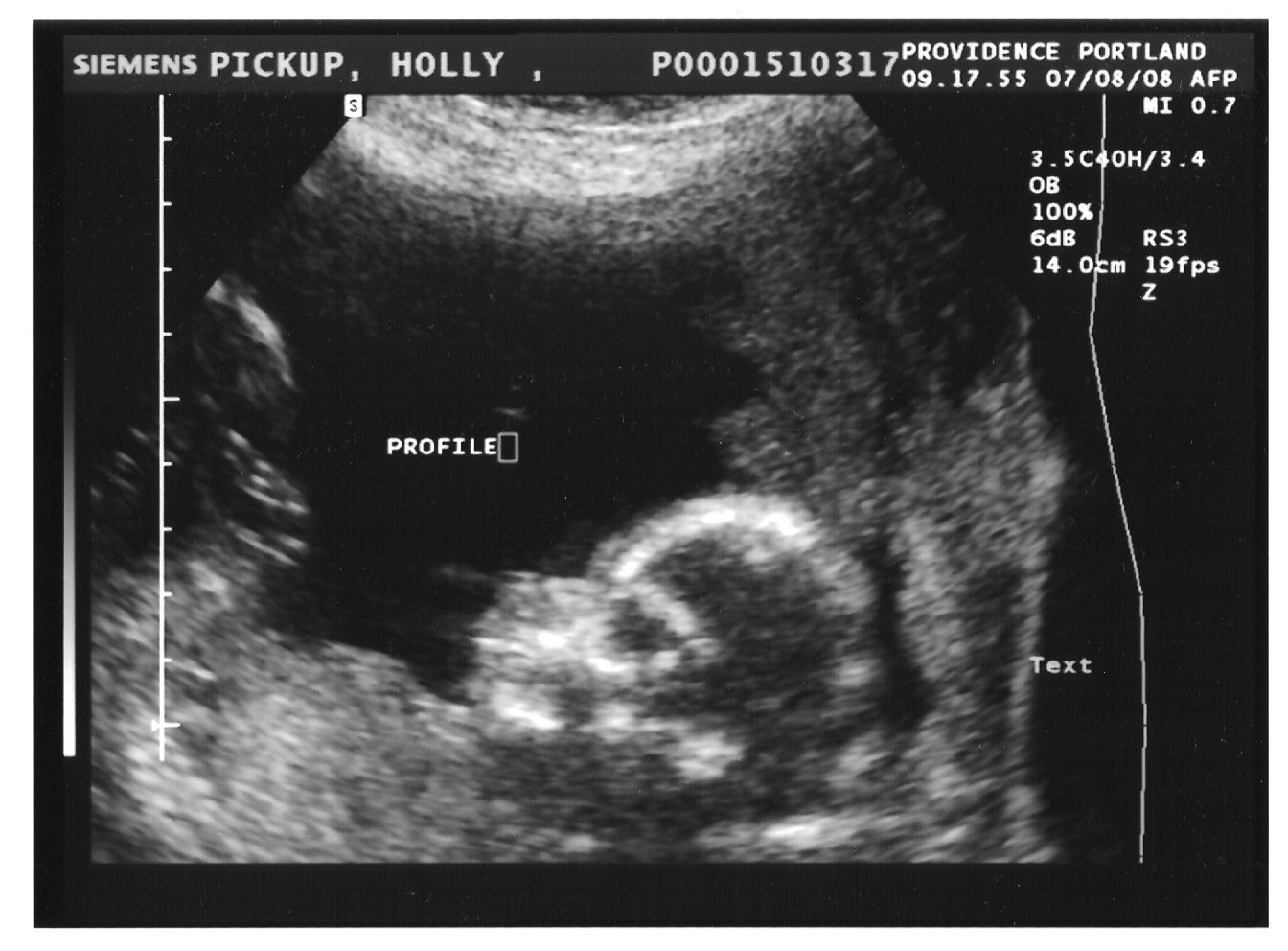 [Baby+Girl+Ultrasound.jpg]