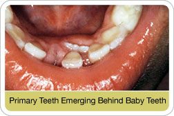 [childrens-dentistry_08.jpg]