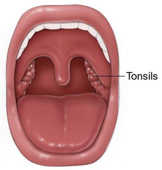[tonsils.jpg]