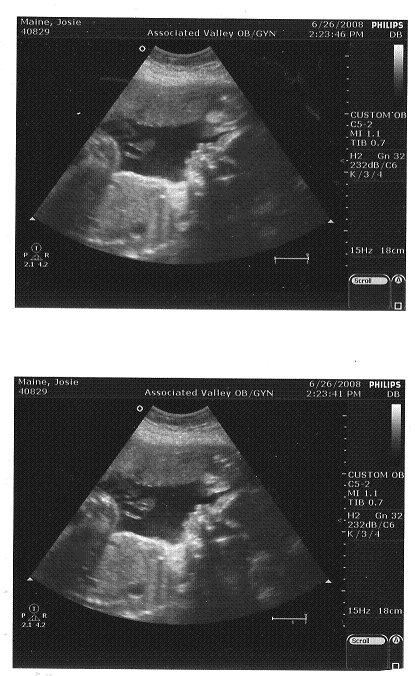 [shelby+scan+June+26,+2008+7mo.bmp]
