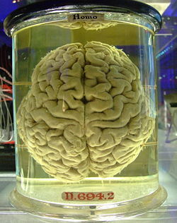 [250px-Human_brain_-_please_add_comment_or_fav_this_if_you_blog_with_it__%28421949167%29.jpg]