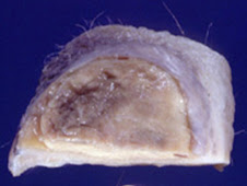 Granuloma subcutáneo (perro)