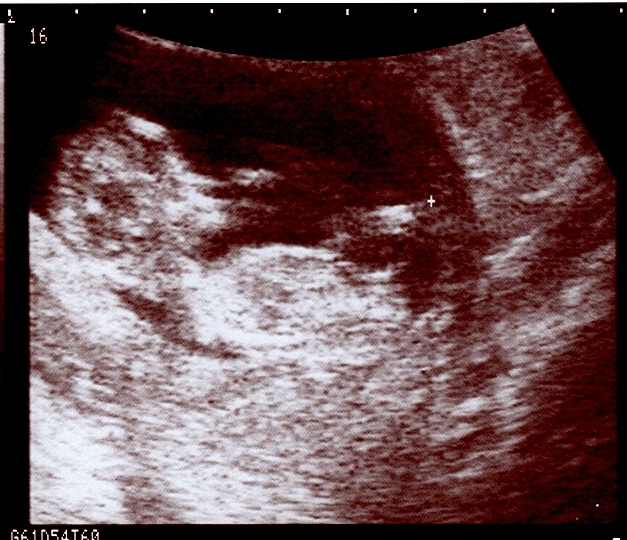 [12_week_ultrasound.jpg]