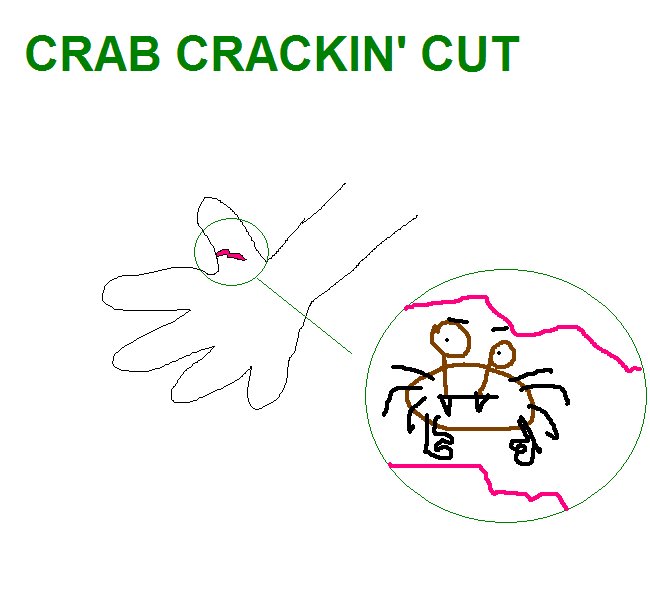 [crab.bmp]
