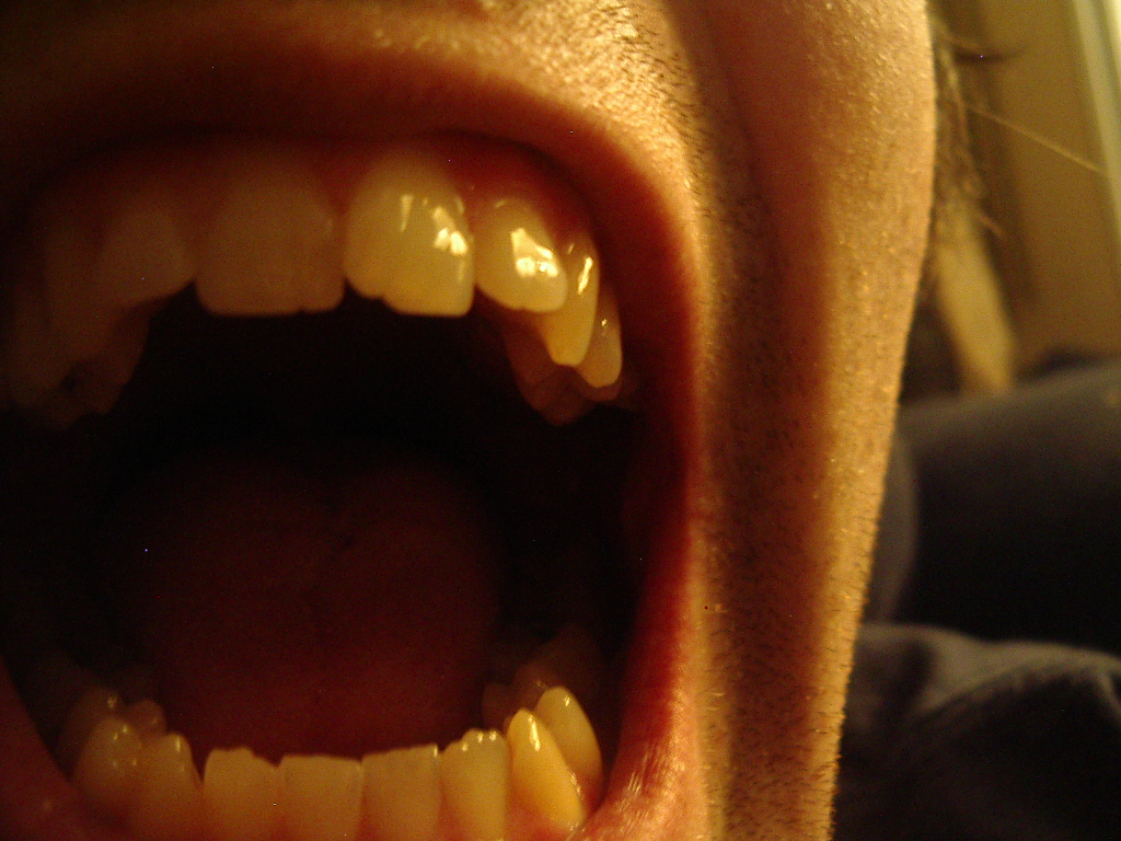 [LeBonCafe+11+teeth.JPG]