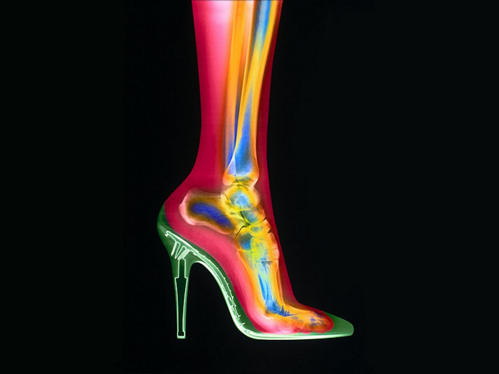 [X-Ray_Vision,_High_Heel_Shoe_And_Foot.jpg]