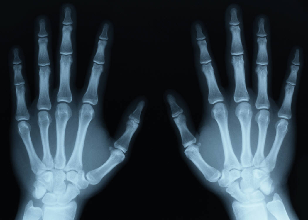 [X-ray-hands.jpg]