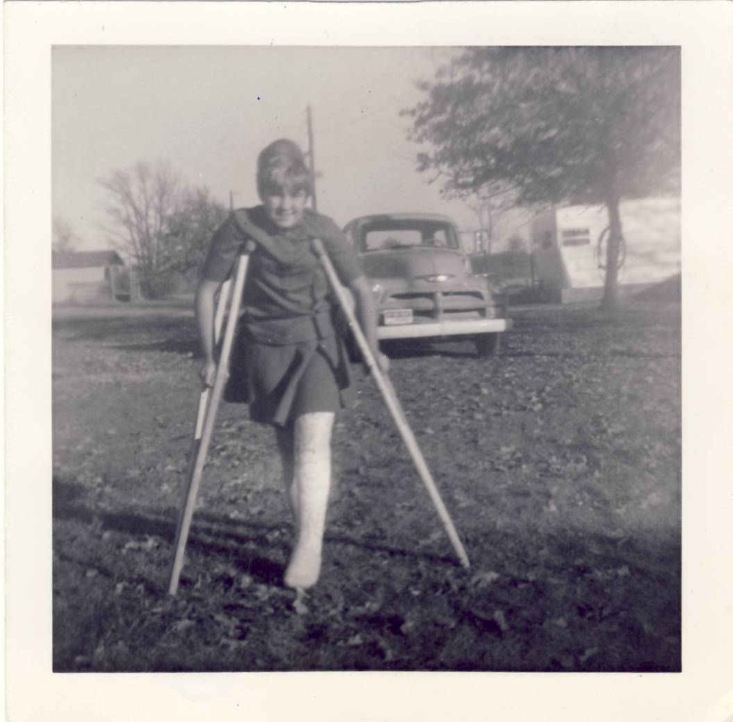 [Carla+&+broken+leg-Jay+1967.JPG]