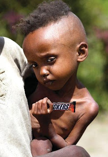Starving child clutching a life-saving Snicker's bar