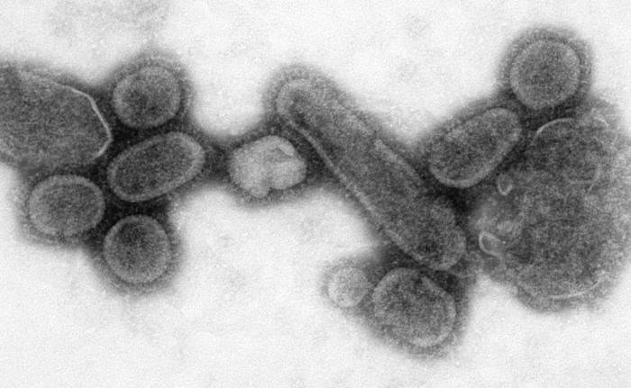 [Reconstructed_Spanish_Flu_Virus.jpg]