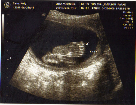 [ultrasound-foot.jpg]