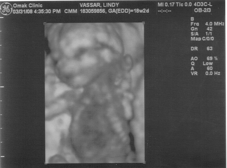 [3-08+ultrasound.jpg]