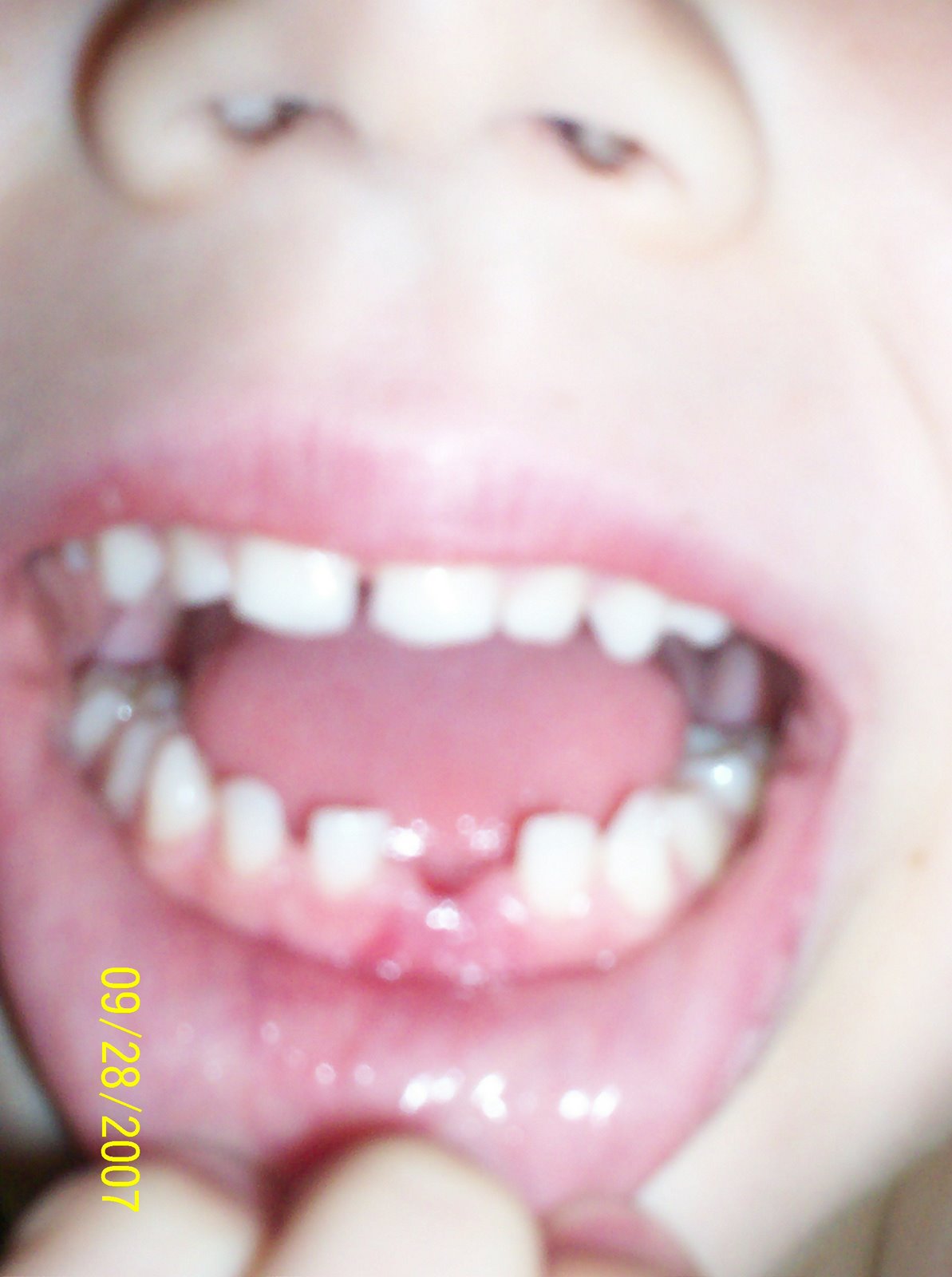 [070928+NBD+first+lost+tooth+hole+in+mouth.jpg]
