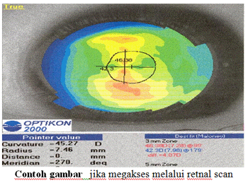 [RetinalScan-16.gif]