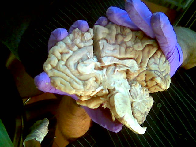 [Brain+dissection.jpg]