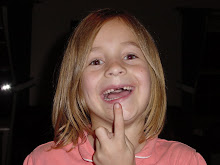 Rachel finally lost her other front tooth!
