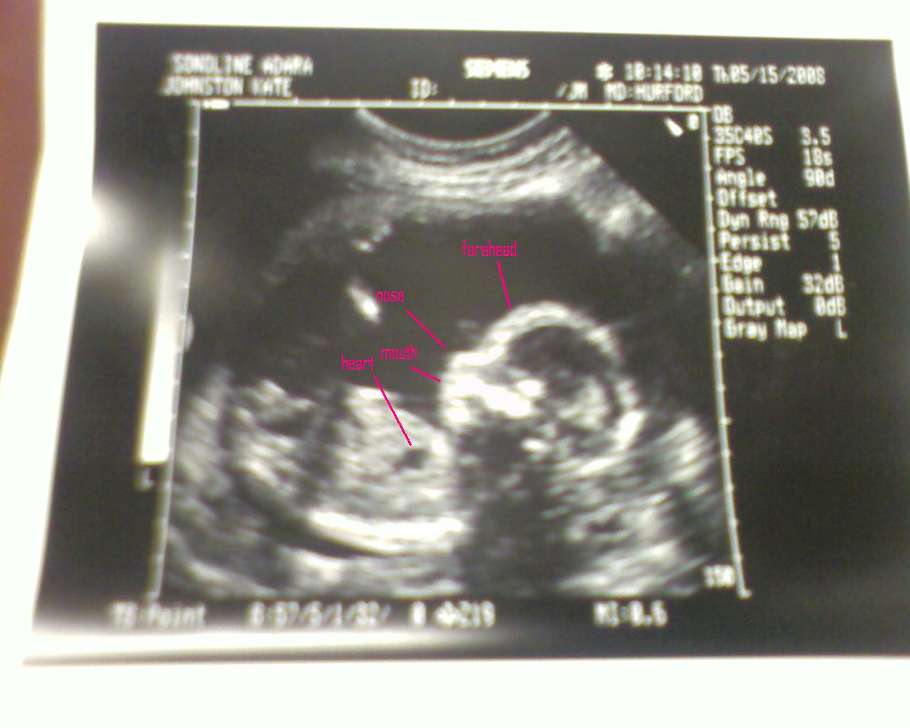 [baby+ultrasound.JPG]