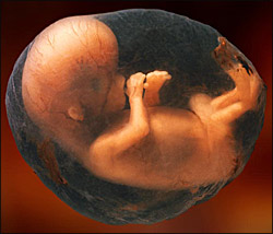 [8week-fetus.jpg]