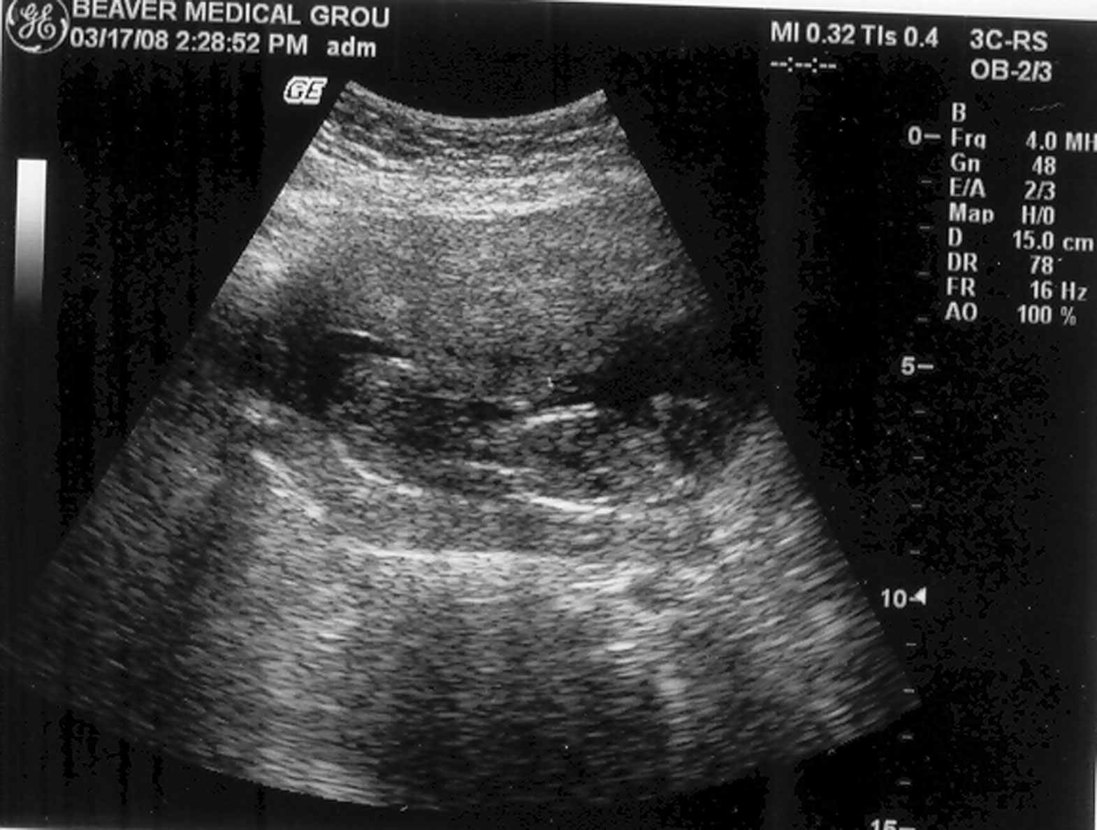 [ultrasound#4-jpeg.jpg]