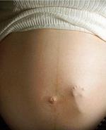 [Pregnant%20Belly%202%20Above%20the%20Law%20blog.jpg]