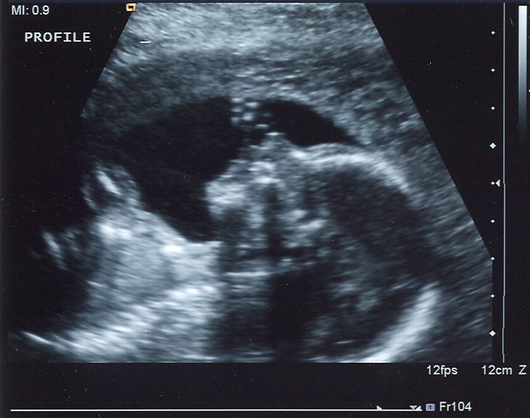 [ultrasound_profile2.jpg]