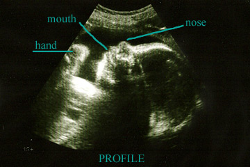 [Profile-Ultrasound.jpg]