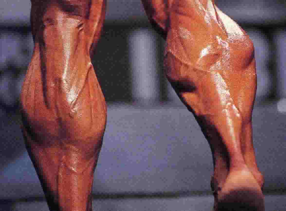[calves-calf-exercise-muscle-picture.jpg]