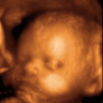[4d+ultrasound.jpg]