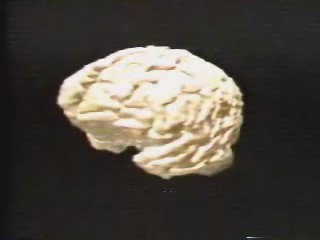 [brain.jpg]