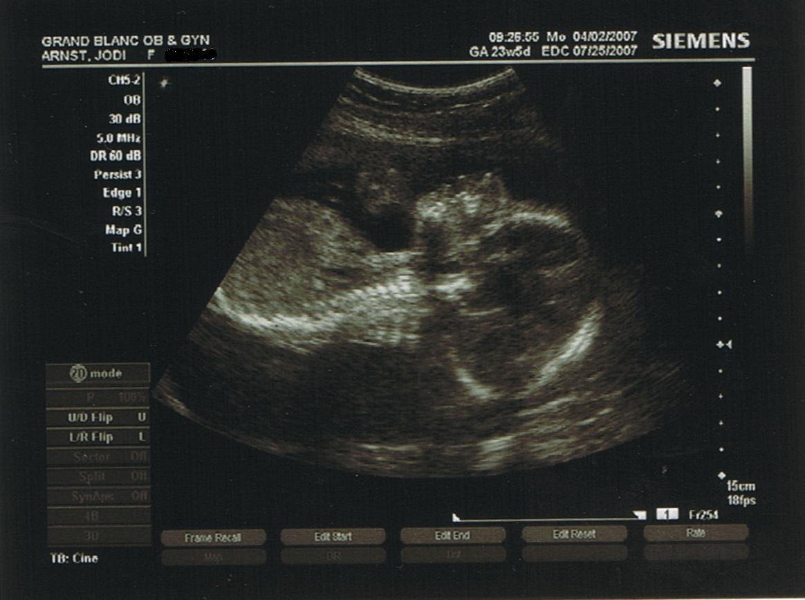 [ultrasound1.JPG]