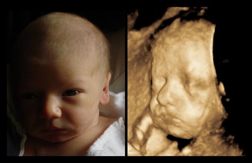 [3D+ultrasound+and+newborn+baby-771083.jpg]
