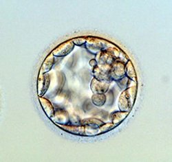 [blastocyst.jpg]