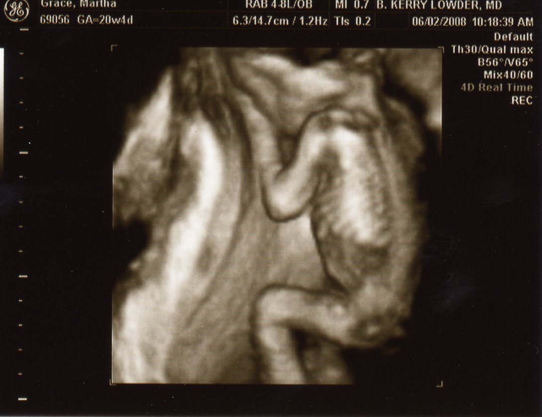 [Ultrasound+-+Baby#3+20Wk023.jpg]