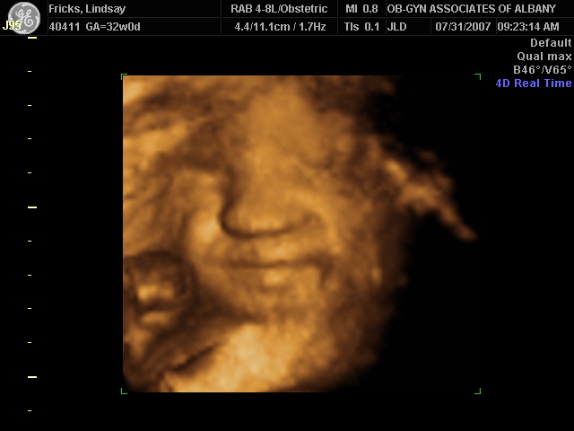 [4D+ultrasound+of+Will+009.jpg]