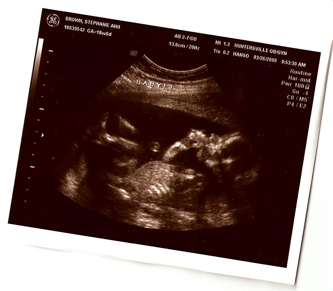 [baby+ultrasound.jpg]